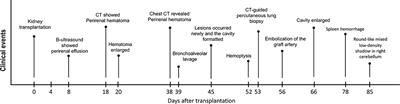 The Double-Edged Sword of Immunosuppressive Therapy in Kidney Transplantation: A Rare Case Report of Pulmonary Mucormycosis Post-Transplant and Literature Review